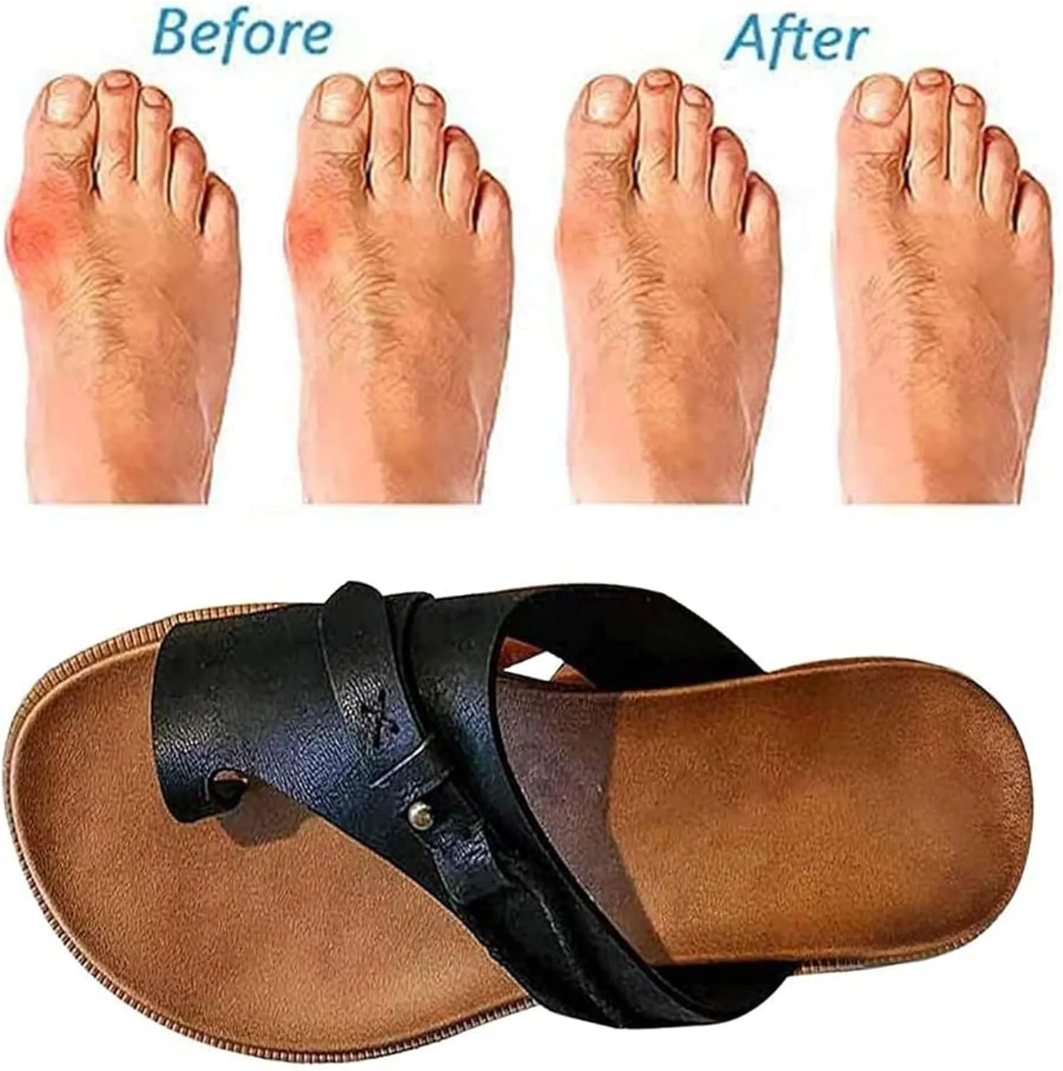 Women's Comfy Sandal Bunion Corrector Shoes Platform Soft Sole with Toe Arch Support Summer Breathable Casual Beach Travel Shoes,Brown,EU38/US7